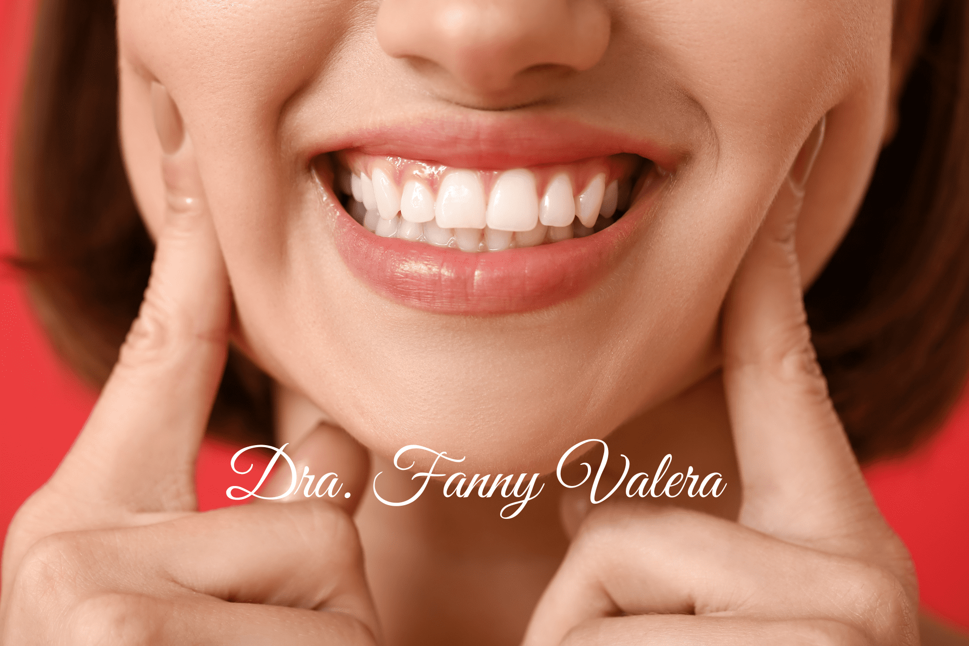 Gingival Sculpting, Reshaping Gum Tissue