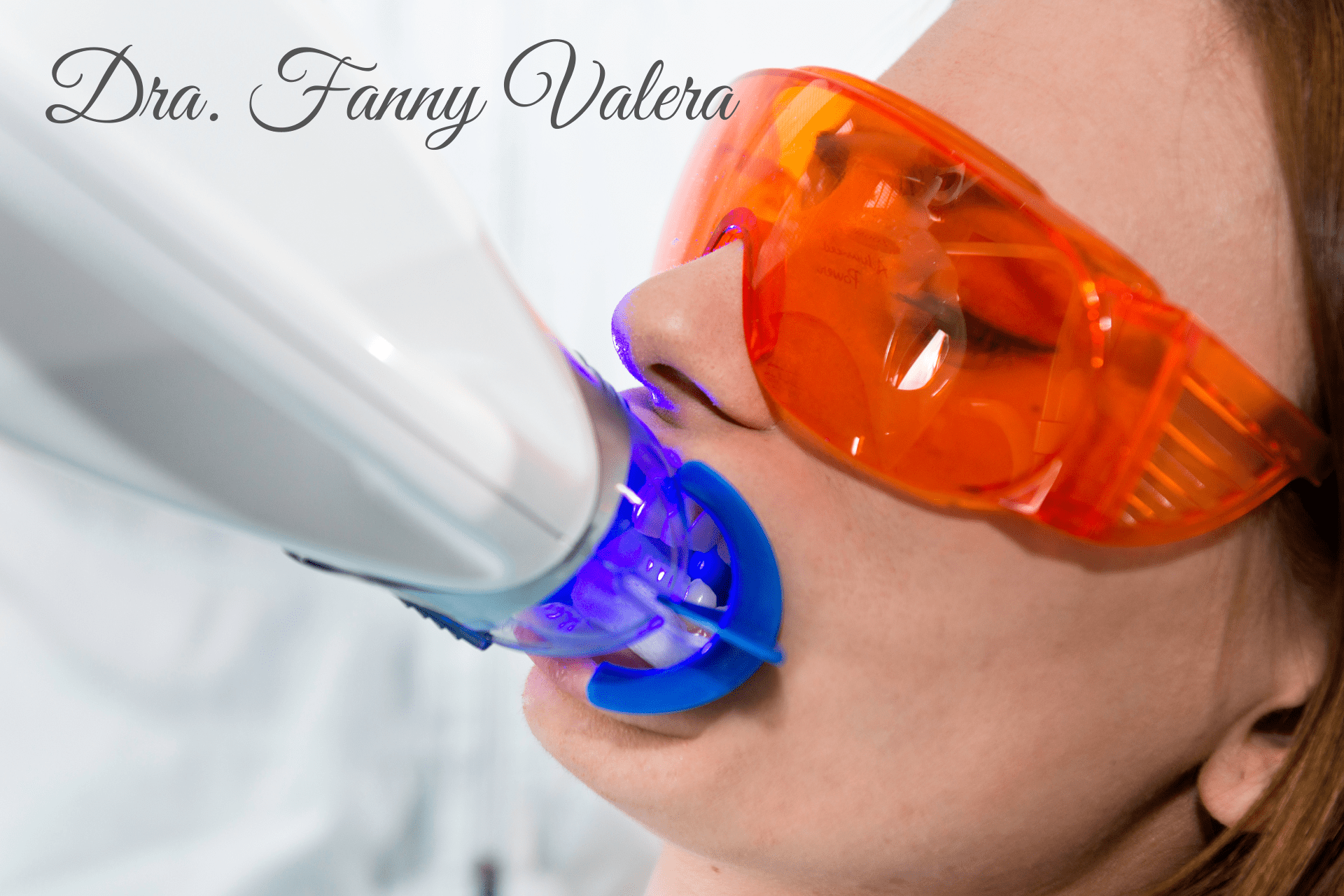 teeth whitening,
