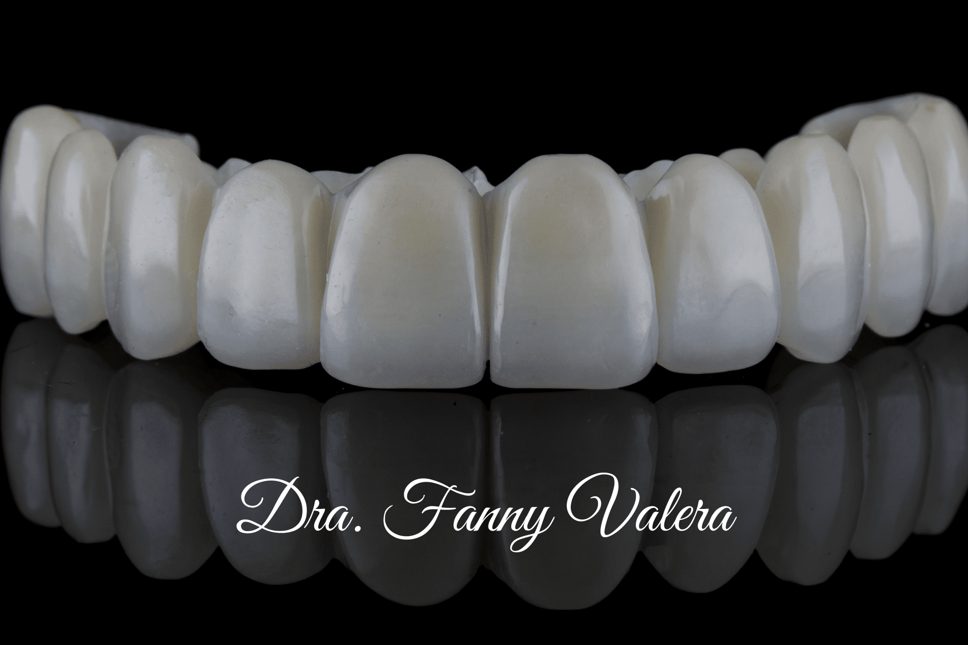 dental bridge, smile makeover cartagena, dental clinic, dental bridges prices cartagena, zirconia dental bridges