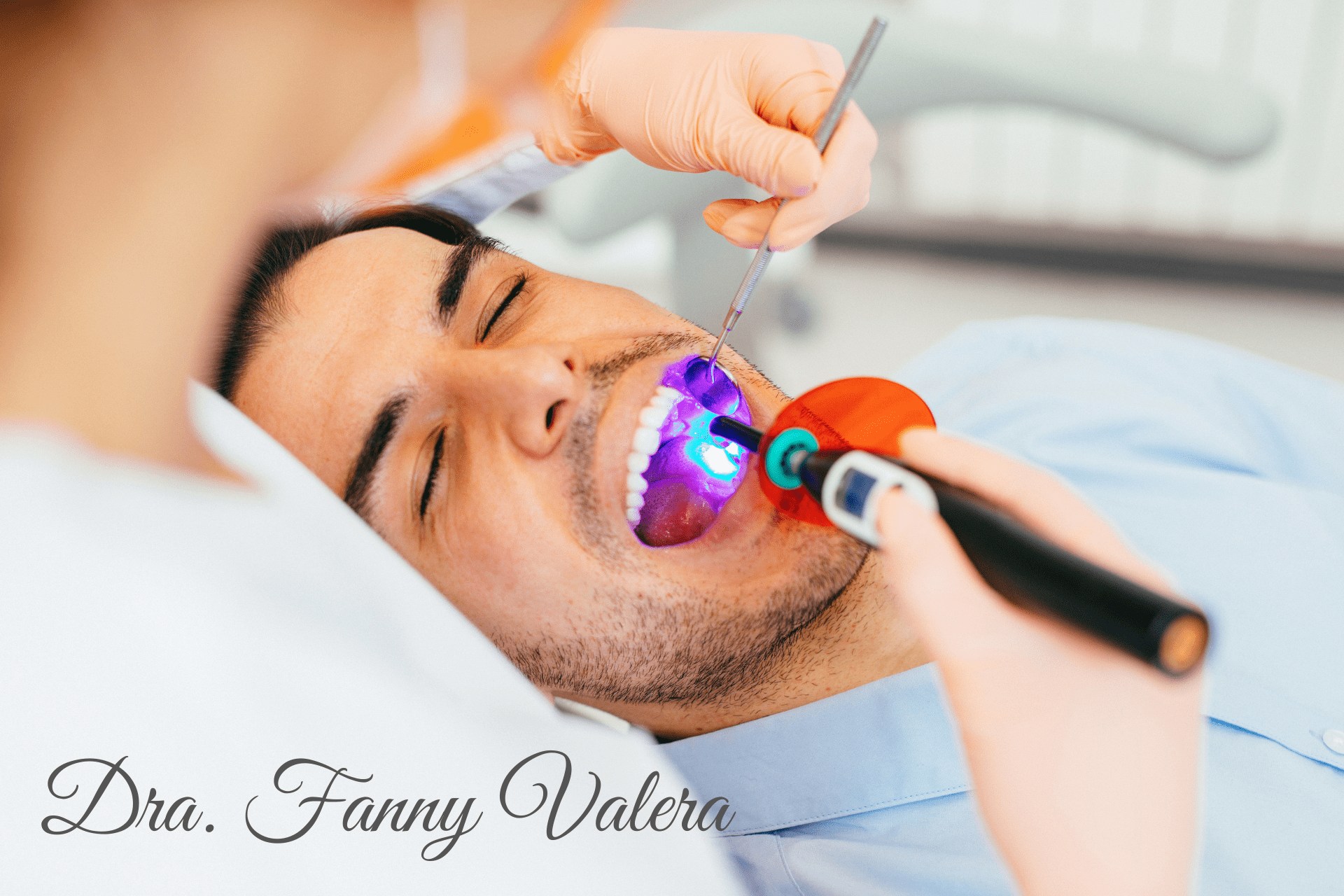 dental treatmenet composite fillings, smile makeover cartagena, dental clinic, dental fillings prices cartagena