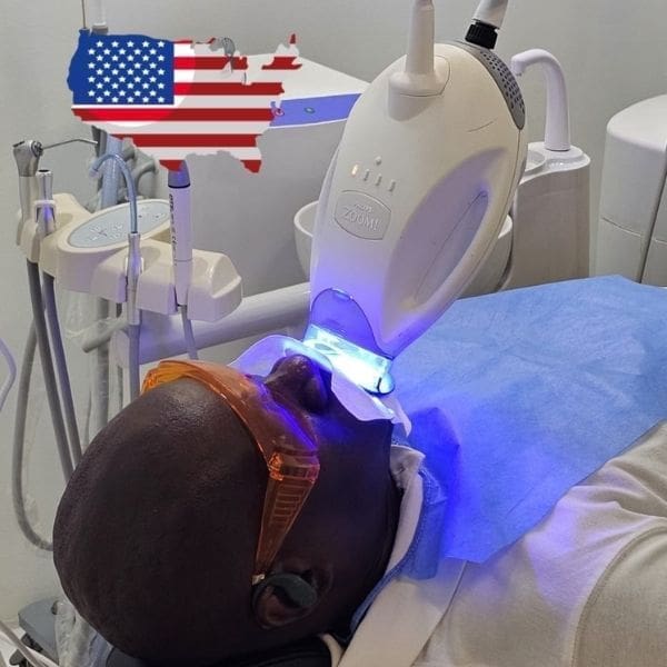 smile makeover cartagena (58)