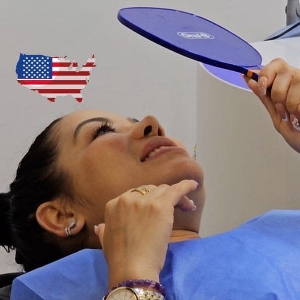smile makeover cartagena (60)