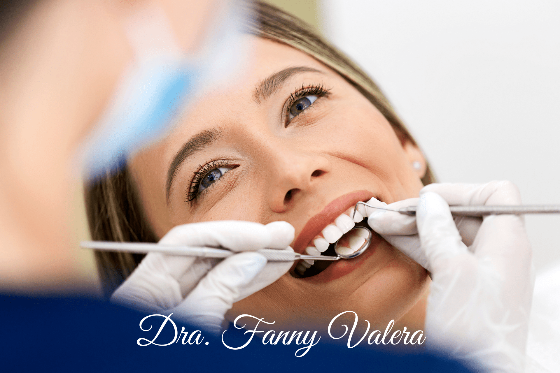 paquete carillas dentales de porcelana, paquete diseño de sonrisa carillas dentales de porcelana, smile design porcelain veneers, porcelain veneers package cartagena