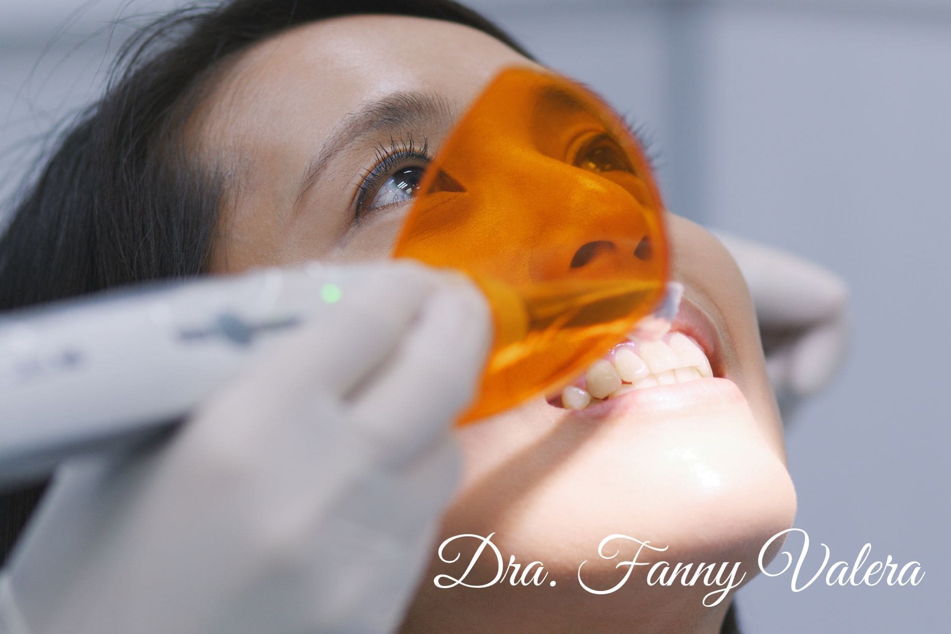 Full teeth whitening smile makeover cartagena (5) full teeth whitening, best teeth whitening, teeth whitening prices cartagena